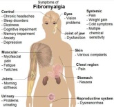 Fibromyalgia Symptoms