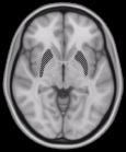 fMRI of the brain