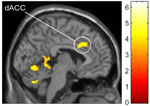 fmri image of the brain