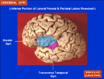 insula region of the brain