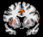 FMRI of the human brain