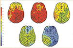 EEG brain maps