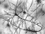 pyramidal neuron