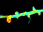 dendritic spine formation