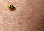 bug on the skin