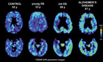 brain scans from the study