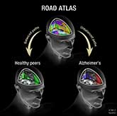 Road Map to Alzheimer’s Disease