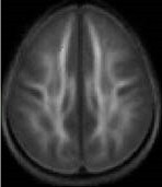 behavior_training_brain_3