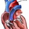 Aorta_heart