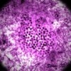 Virus
