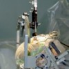 deep_brain_stimulation_stock