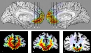 ventral_medial_lateral_images