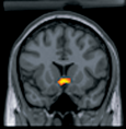 FMRI Brain