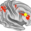 fmri of the brain