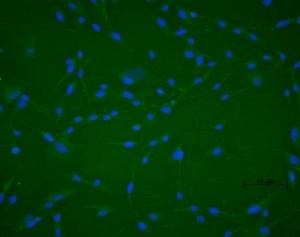 stem cells Stem Cells