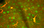 Astrocytes