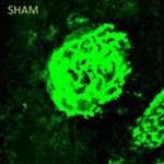 Retina Vessels