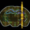 ‘Sound’ Science Offers Platform For Brain Treatment And Manipulation Ultrasound Pulse
