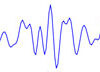 Example of beta in the EEG