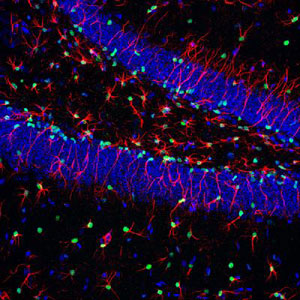 stem-cells Stem Cells