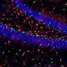 Stem Cells