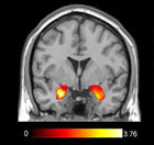 MRI of the human amygdala