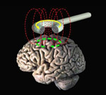 Illustration of Transcranial Magnetic Stimulation