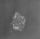 stem cells exposed to second hand smoke