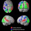MRI of the attention and sensory areas