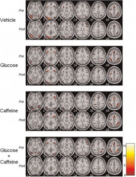 fmri images of the brain on caffeine from a study