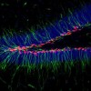Deep brain stimulation of the anterior thalamic nucleus in the mouse brain results in an increase in the number of new neurons due to an increase in cell division in the mouse hippocampus, specifically among neural stem (green) and progenitor cells (pink). (Credit - Grigori Enikolopov at CSHL)