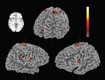fMRI-Scan-Showing-Real-time-Changes-to-music fMRI Scan Showing Real-time Changes in Neural Activity