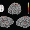 fMRI Scan Showing Real-time Changes in Neural Activity to music