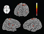 fMRI Scan Showing Real-time Changes in Neural Activity to music