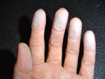 lead dust on human hands