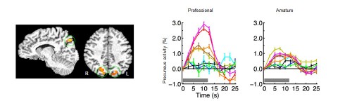 Figure 1 shows fmri results