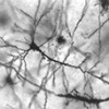 pyramidal neuron