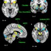 brain imaging of mothers' brains