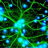Astrocytes