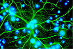 Astrocytes