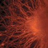 Stem Cells Therapy Holds Promise For People With Rapidly Progressing Multiple Sclerosis neuron developed from stem cells