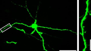 Lateral-habenula-study Lateral habenula neuron