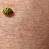 bug on the skin