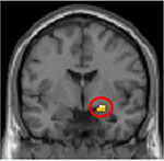 brain image