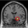 Brain Imaging Shows That A Sense Of Justice Is Built Into The Brain Image of the brain