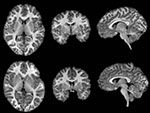MRI images from the study