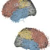 electrode placement used in the study