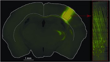 neuronal-cell-study rat brain cells