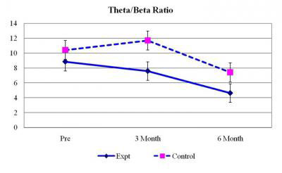 Graph of theta to beta ratios