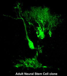 adult-stem-cell-clone-study adult stem cell